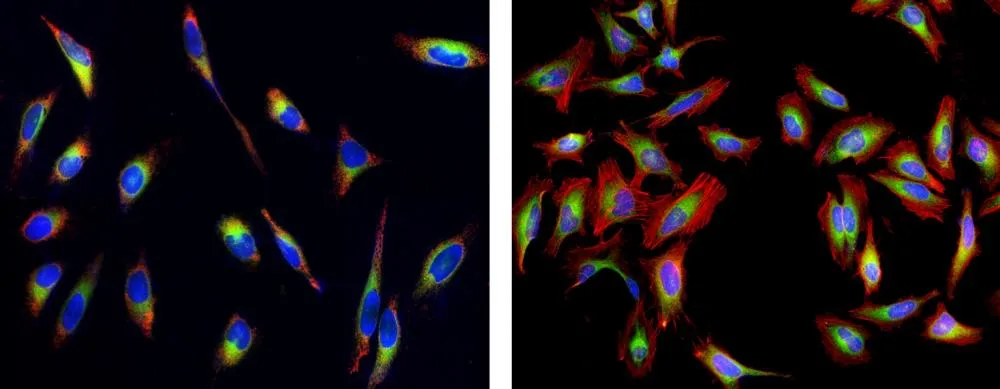 Cell Navigator® Live Cell Endoplasmic Reticulum (ER) Staining Kit *Green Fluorescence* - image 1