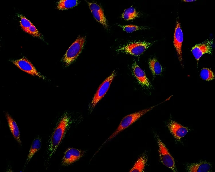 Cell Navigator® Live Cell Endoplasmic Reticulum (ER) Staining Kit *Red Fluorescence* - image 2