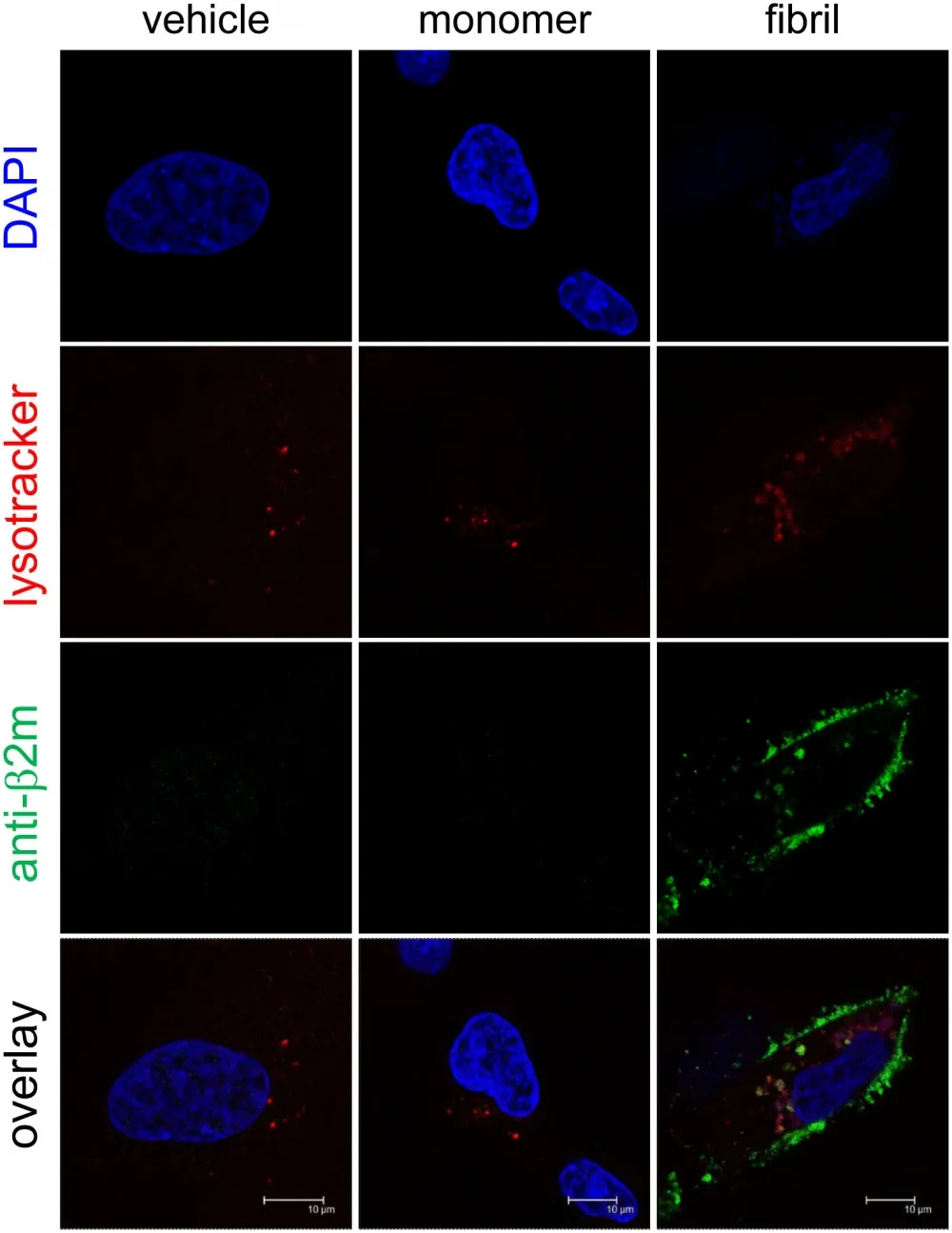 Cell Navigator® Lysosome Staining Kit *Blue Fluorescence* - image 2