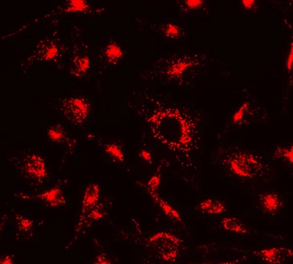 Cell Navigator® Lysosome Staining Kit *Orange Fluorescence* - image 1