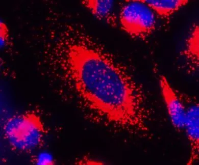 Cell Navigator® Lysosome Staining Kit *Red Fluorescence* - image 2