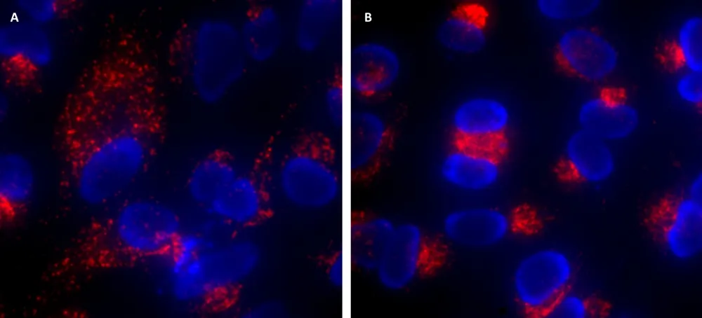 Cell Navigator® Lysosome Staining Kit *Red Fluorescence* - image 4