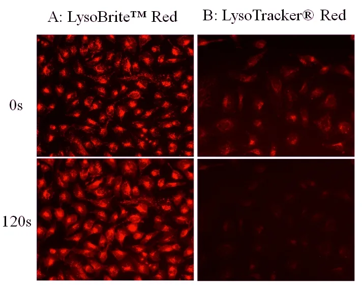 Cell Navigator® Lysosome Staining Kit *Red Fluorescence* - image 5