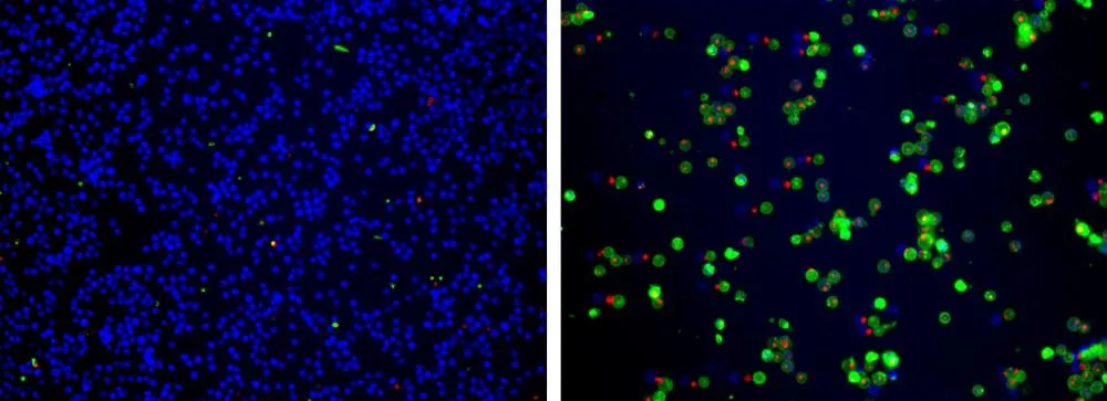 Cell Meter™ Apoptotic and Necrotic Multiplexing Detection Kit I *Triple Fluorescence Colors* - image 1