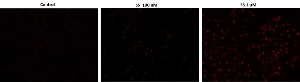 Cell Meter™ Live Cell TUNEL Apoptosis Assay Kit *Red Fluorescence* - image 1