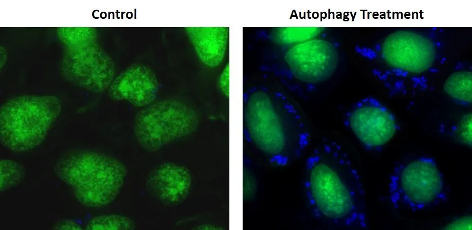 Cell Meter™ Autophagy Fluorescence Imaging Kit - image 1
