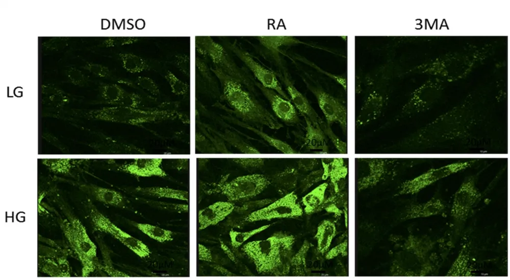 Cell Meter™ Autophagy Assay Kit *Green Fluorescence* - image 2