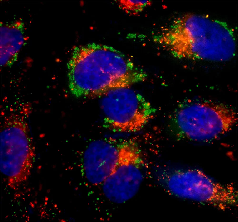 Cell Meter™ Autophagy Assay Kit *Green Fluorescence* - image 3