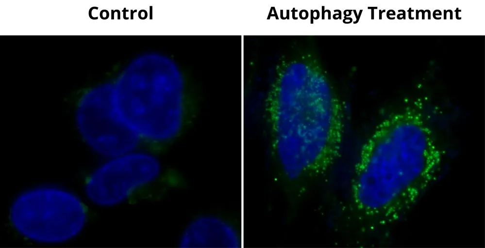Cell Meter™ Autophagy Assay Kit *Green Fluorescence* - image 4
