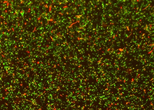 MycoLight™ Rapid Fluorescence Bacterial Gram Stain Kit - image 1