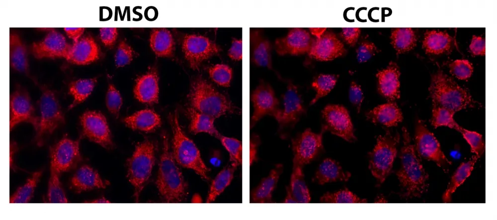 Cell Meter™ Mitochondrial Autophagy Imaging Kit *Red Fluorescence* - image 1