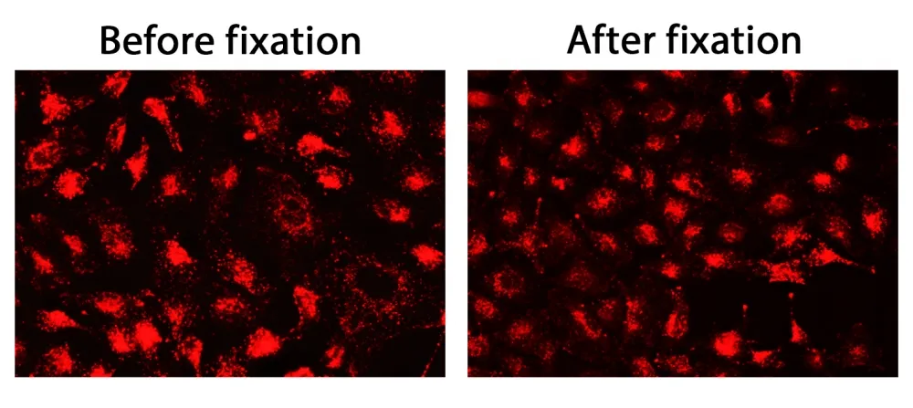 CytoFix™ Red Lysosomal Stain - image 1