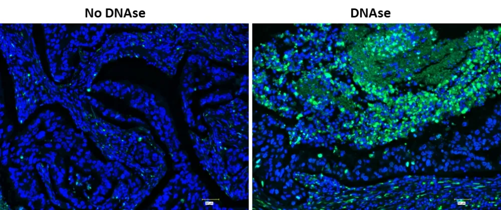 Cell Meter™ Fixed Cell and Tissue TUNEL Apoptosis Assay Kit *Green Fluorescence* - image 1