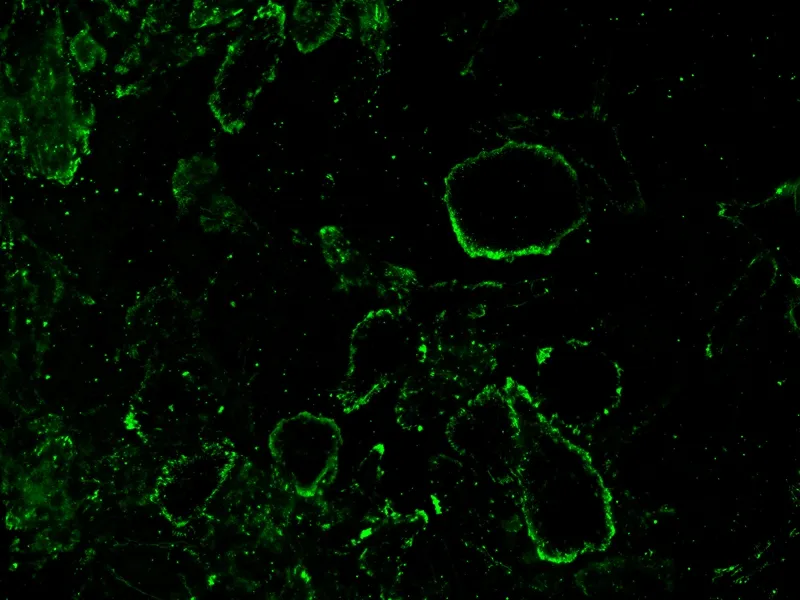 iFluor® 488-Concanavalin A Conjugate - image 1