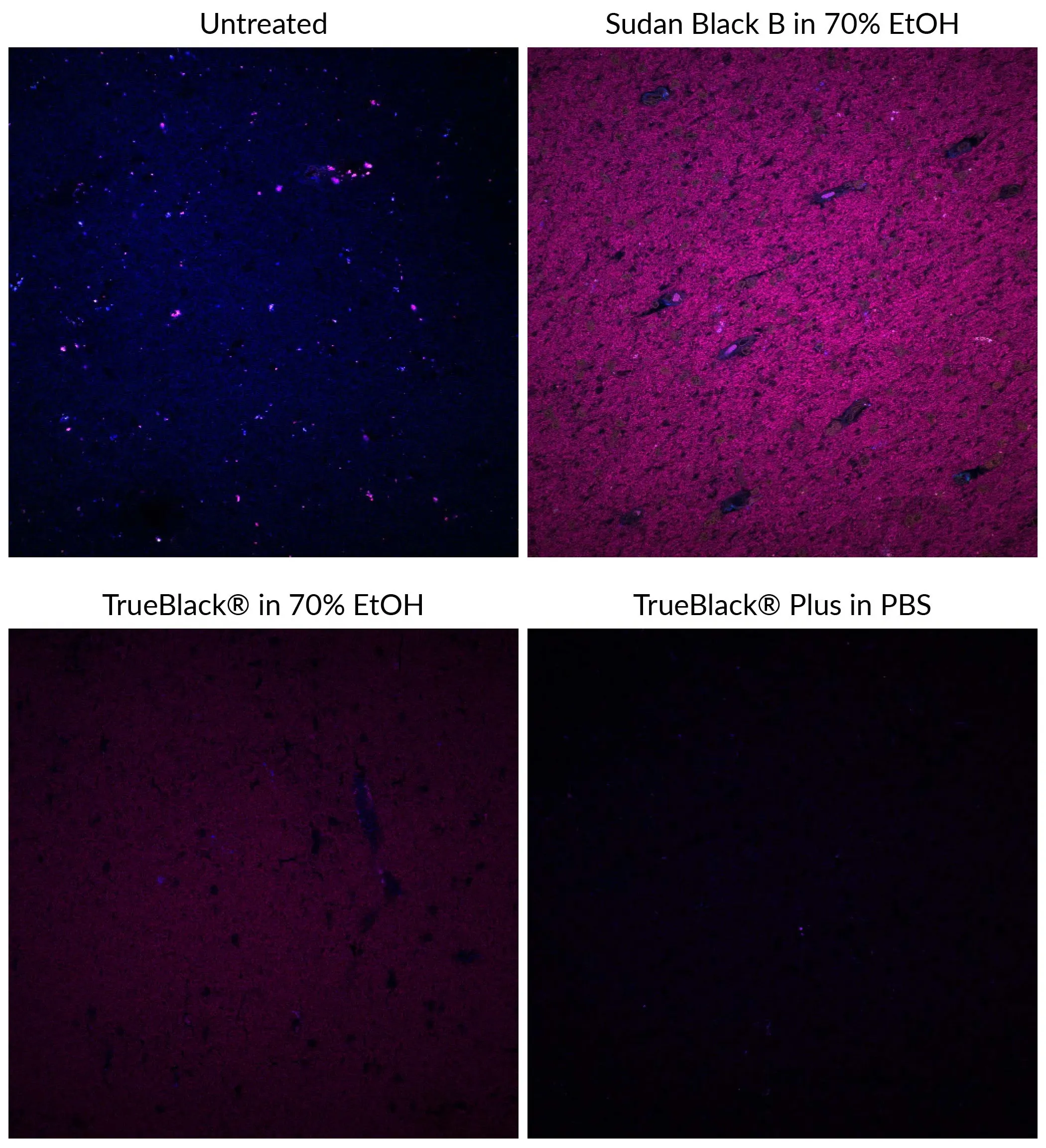 TrueBlack® Plus Lipofuscin Autofluorescence Quencher, 40X in DMSO (trial size) - image 2