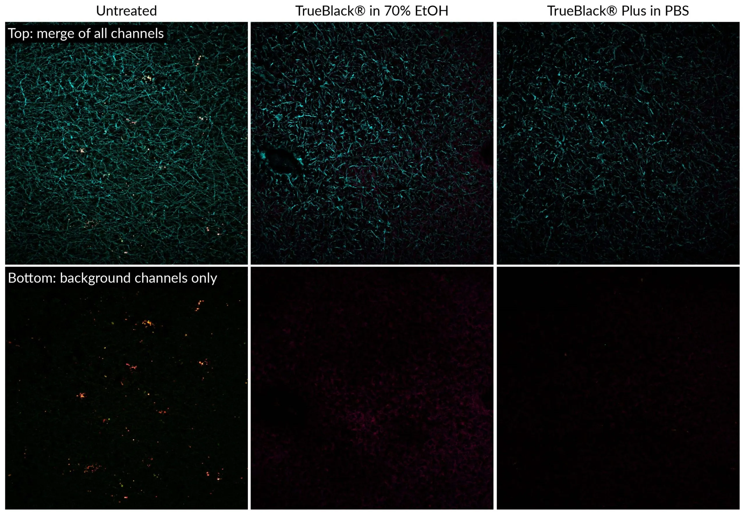TrueBlack® Plus Lipofuscin Autofluorescence Quencher, 40X in DMSO (trial size) - image 3