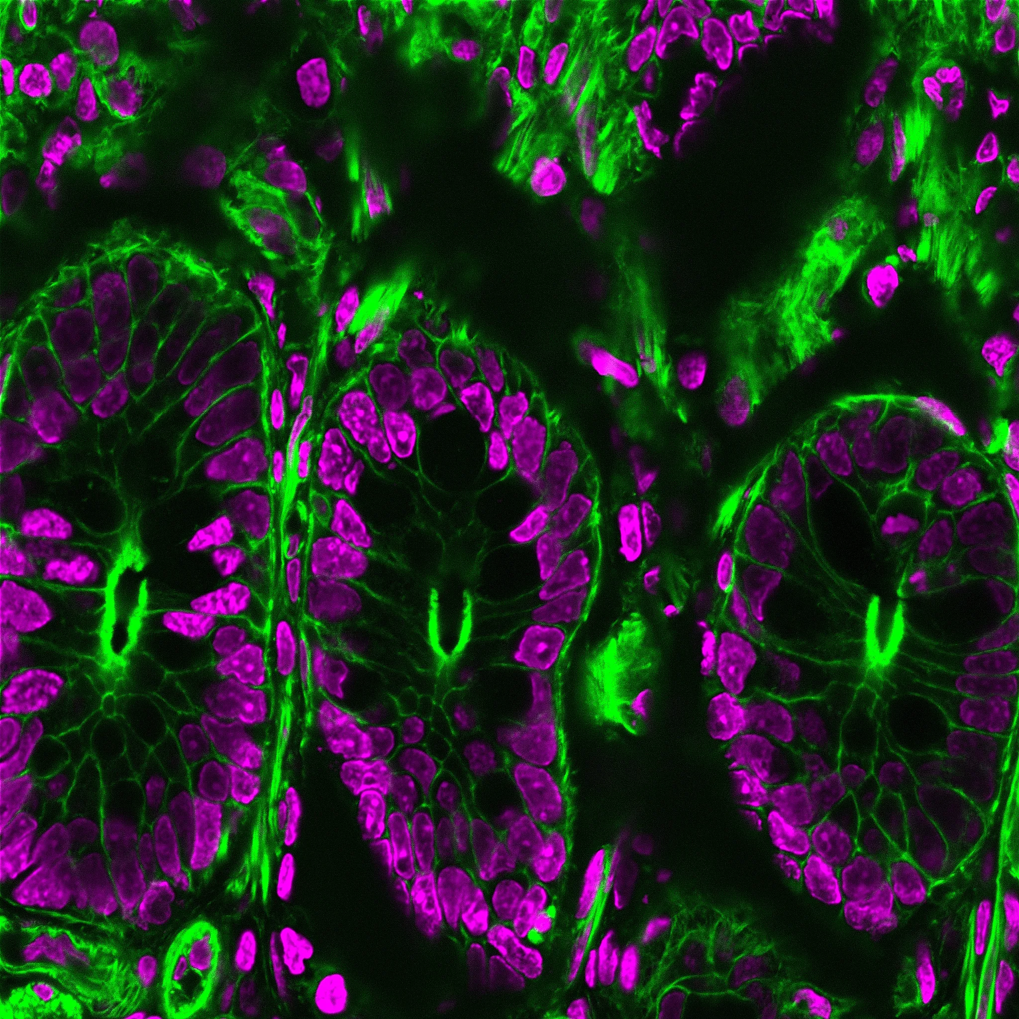 NucSpot® 555/570, 1000X in DMSO (trial size) - image 4