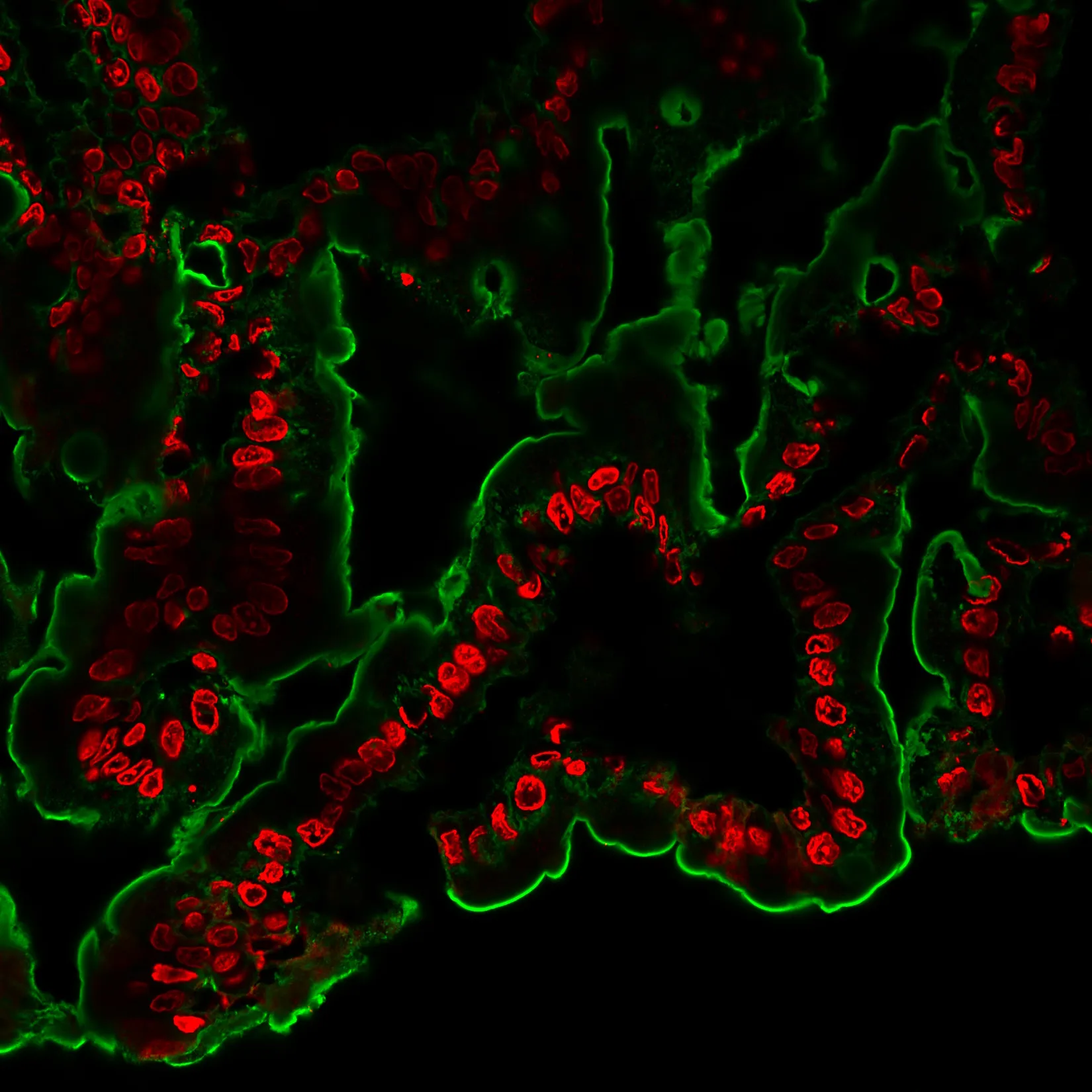 NucSpot® 555/570, 1000X in DMSO (trial size) - image 5