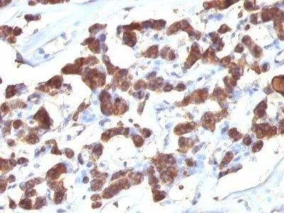 Anti-Thyroglobulin(2H11 + 6E1), CF740 conjugate - image 1