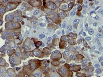Anti-NGFR (Nerve Growth Factor Receptor)(NGFR5), CF740 conjugate - image 1