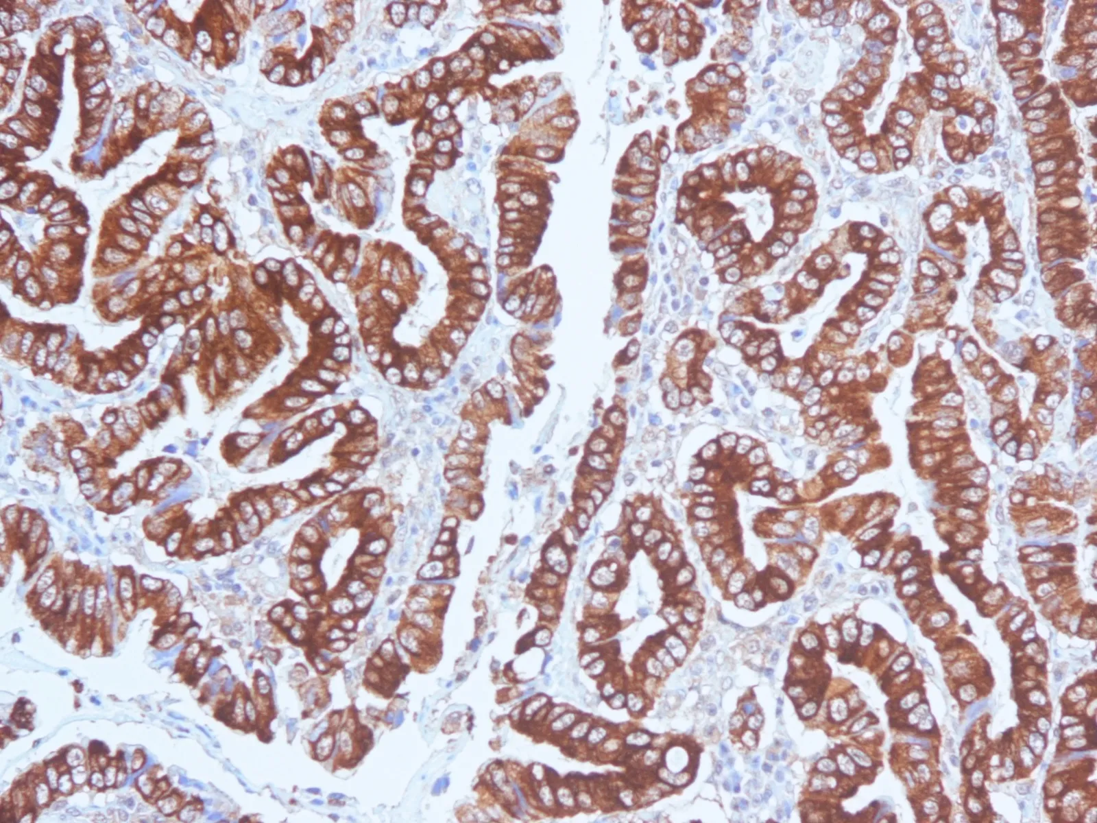 Anti-Mucin 5AC (MUC5AC)(CLH2), CF740 conjugate - image 1