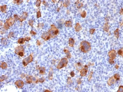CD30 / TNFRSF8 (Hodgkin & Reed-Sternberg Cell Marker) (Ki-1/1747R), CF647 conjugate, 0.1mg/mL
