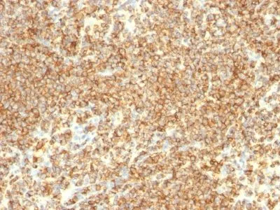 CD20 (IGEL/773), CF740 conjugate, 0.1mg/mL