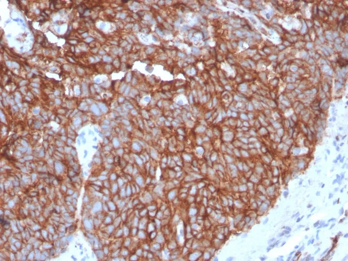 GLUT-1 (Tumor Progression and Mesothelioma Marker) (GLUT1/3132R), CF488A conjugate, 0.1mg/mL