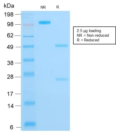 Cytokeratin 16 (KRT16) (Suprabasal Keratinocyte Marker) (rKRT16/1714), CF488A conjugate, 0.1mg/mL thumbnail 2