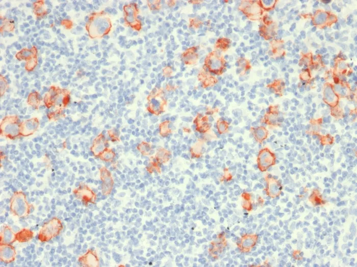 CD30 / TNFRSF8 (Hodgkin & Reed-Sternberg Cell Marker) (rCD30/412), CF640R conjugate, 0.1mg/mL