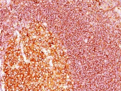 MALT-1 (MT1/410), Biotin conjugate, 0.1mg/mL