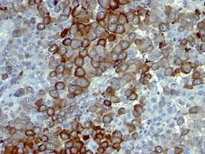 NGFR (Nerve Growth Factor Receptor) (NTR/912), 0.2mg/mL thumbnail 2