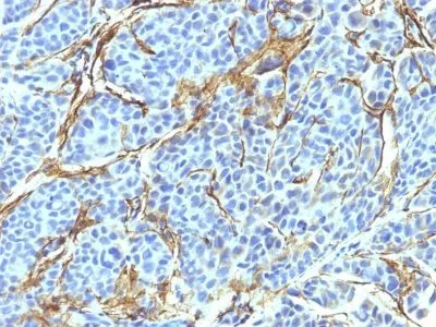 NGFR (Nerve Growth Factor Receptor) (NTR/912), 0.2mg/mL