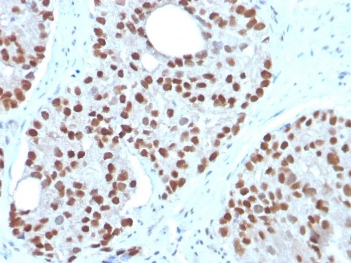 NKX3.1 (Metastatic Prostate Adenocarcinoma Marker) (NKX3.1/3350), CF594 conjugate, 0.1mg/mL