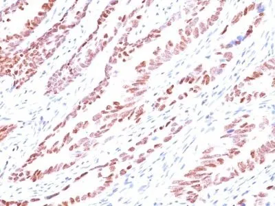 P57 / KIP2 (KP10), CF640R conjugate, 0.1mg/mL