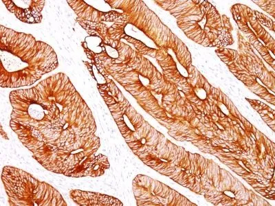 Cytokeratin 8 (K8/383), CF568 conjugate, 0.1mg/mL thumbnail 2