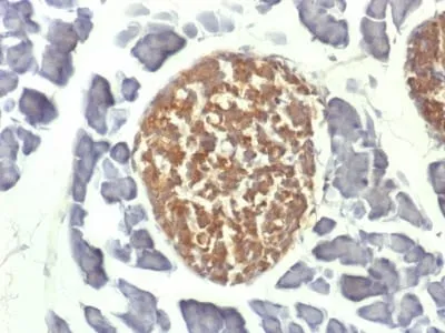 NSE gamma (Neuron Specific Enolase, gamma) (Neuroendocrine Marker) (ENO2/1462), CF568 conjugate, 0.1mg/mL thumbnail 2