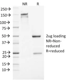 NSE gamma (Neuron Specific Enolase, gamma) (Neuroendocrine Marker) (ENO2/1462), CF568 conjugate, 0.1mg/mL thumbnail 4