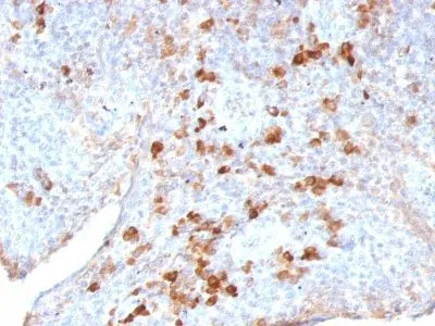 Human Lambda Light Chain (LAM03), 0.2mg/mL - image 1