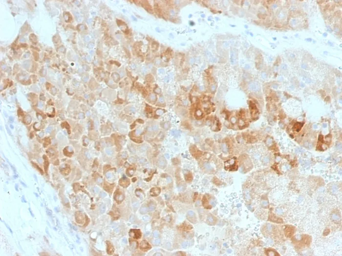 ROR2 (ROR2/1911), 0.2mg/mL - image 1