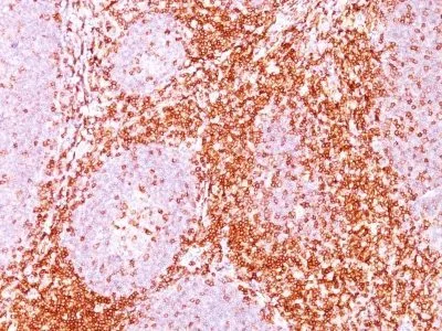 CD6 (C6/372), 0.2mg/mL - image 1