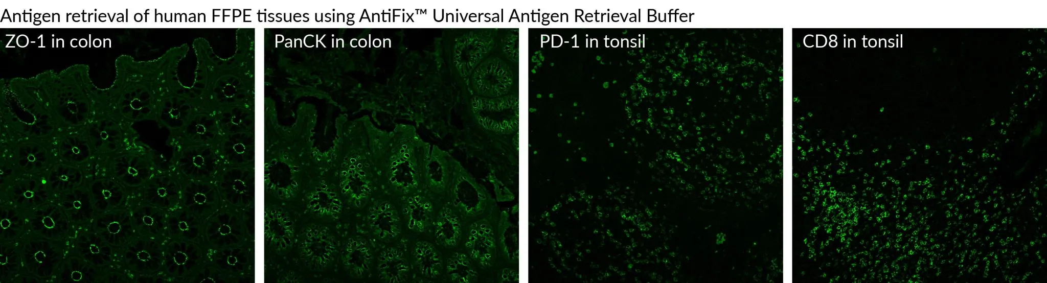 AntiFixTM Universal Antigen Retreival Buffer, 10X, 500 mL - image 2
