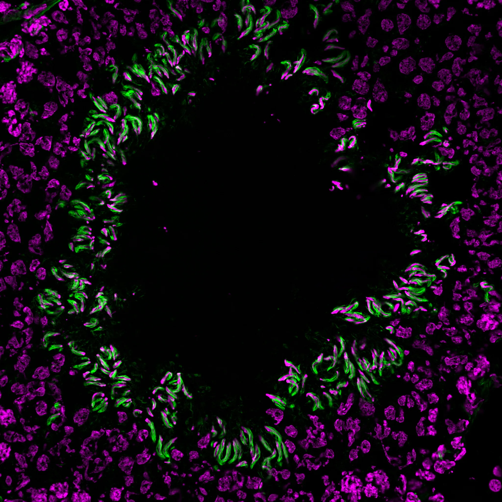 EverBrite TrueBlack® Hardset Mounting Medium with DAPI - image 8