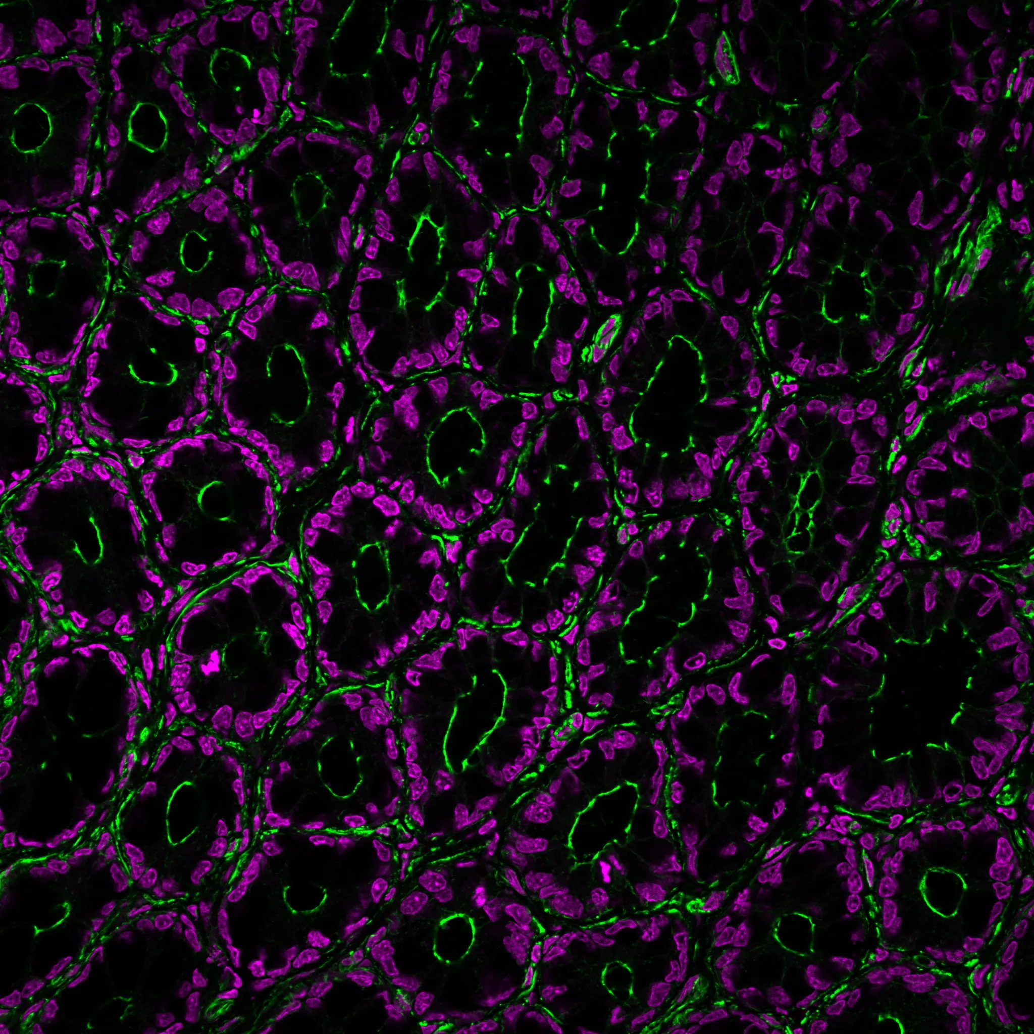 EverBrite TrueBlack® Hardset Mounting Medium with DAPI - image 9