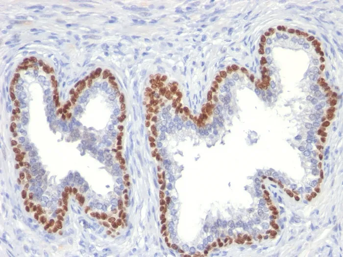 Anti-p63 (Squamous, Basal & Myoepithelial Cell Marker)(TP63/11) - image 1