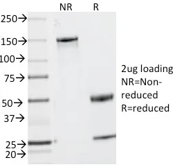 Anti-CD2 / Lymphocyte Function Antigen 2 (LFA-2)(UMCD2) - image 1