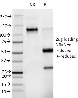 Anti-Phosphotyrosine (P-Tyr)(PY265) - image 1