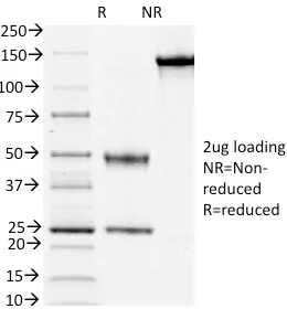 Anti-CD3e (T-Cell Marker)(OKT3) - image 1
