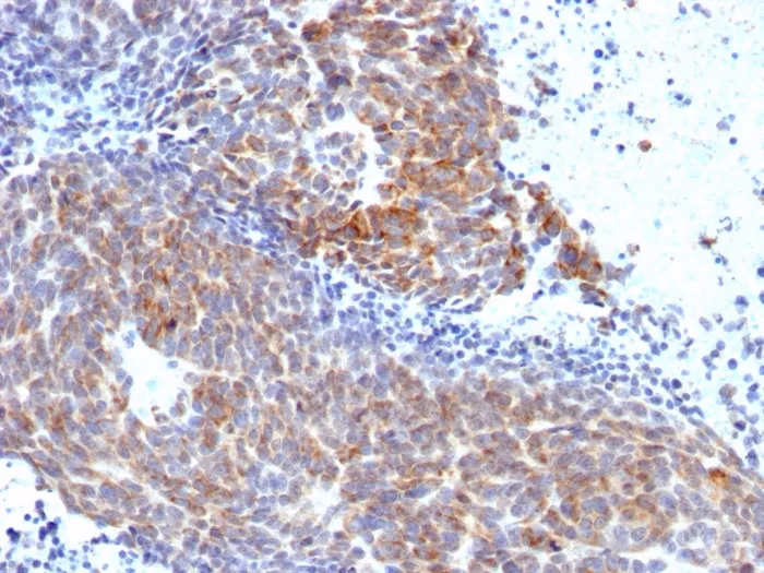Anti-Topoisomerase (DNA) I, Mitochondrial (TOP1MT)(TOP1MT/568) - image 1
