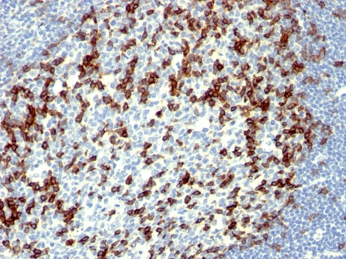 Anti-PDCD1 / PD1 / CD279 (Programmed Cell Death 1)(NAT105) - image 1